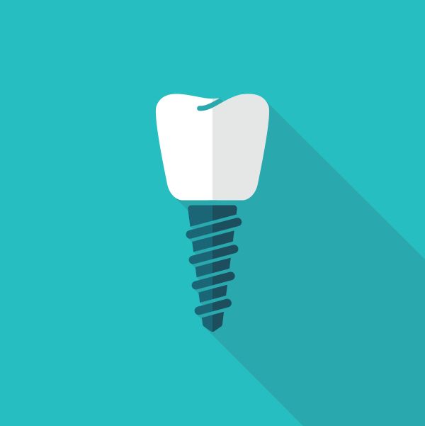 Having Multiple Dental Implants Placed At The Same Time