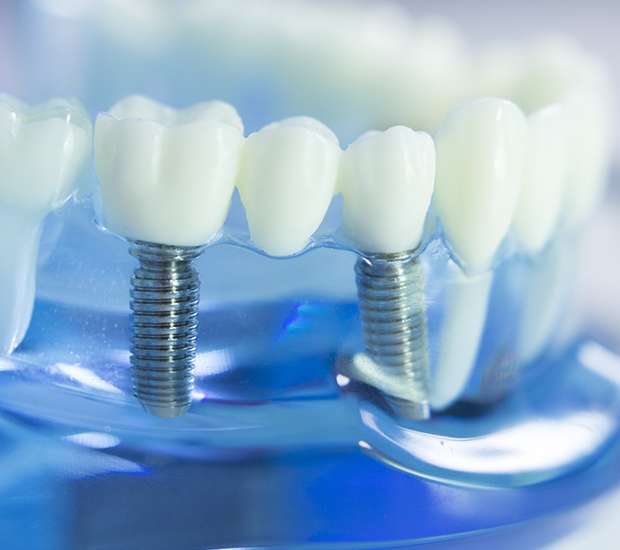 Morristown Dental Implants
