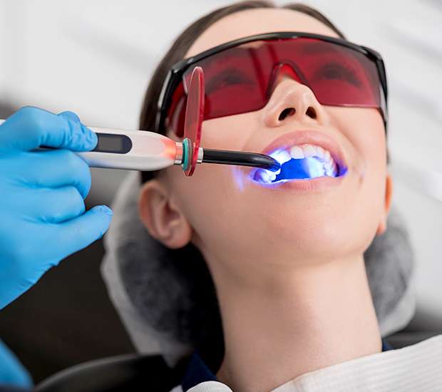 Morristown Professional Teeth Whitening
